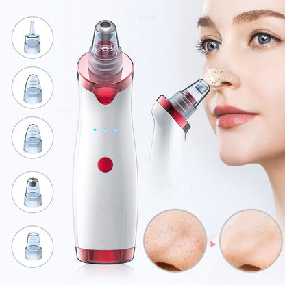 Electric Vaccum Acne Removal-Rechargable
