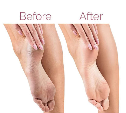 Electric Foot File for Heels Grinding Pedicure Tools Callus Remover