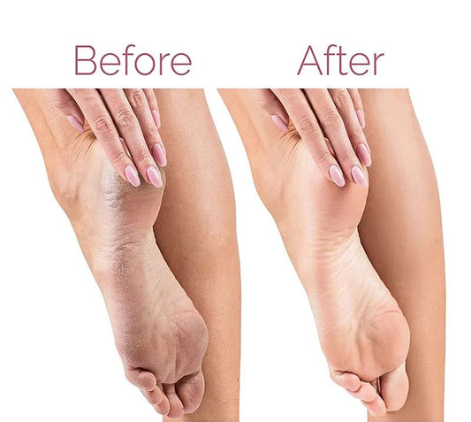Electric Foot File for Heels Grinding Pedicure Tools Callus Remover